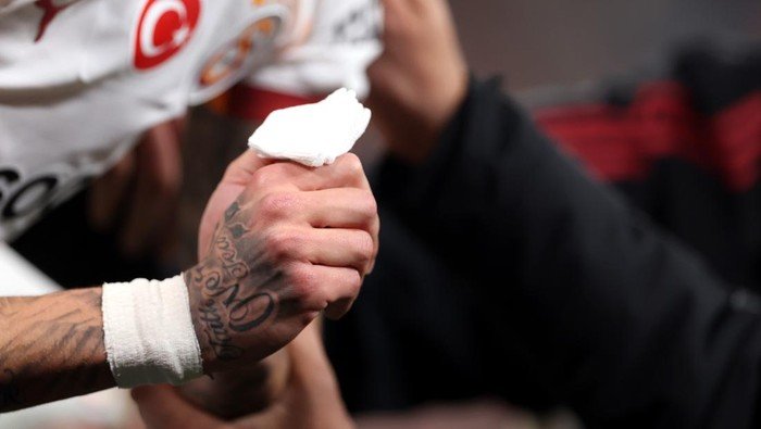 Cedera Horor Noa Lang, Jari Nyaris Putus Terjepit Papan Iklan Anfield: Bencana Liga Inggris